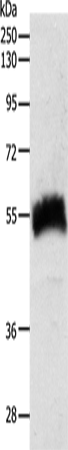 Anti-Human/Rat SLC22A6 Antibody - ABMIUM