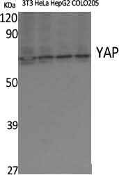 Anti-Human/Mouse/Rat YAP1 Antibody