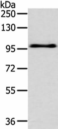 Western blot analysis of Hela cell using EPHA3 Polyclonal Antibody at dilution of 1:400