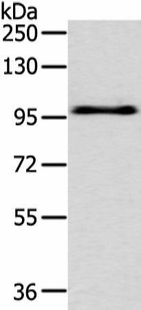 Western blot analysis of Hela cell using EPHA3 Polyclonal Antibody at dilution of 1:400