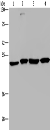 Anti-Human CCR6 Antibody - ABMIUM