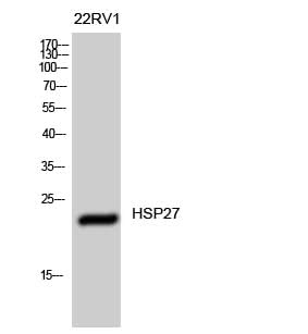 Western Blot analysis of 22RV1 cells using HSP27 Polyclonal Antibody at dilution of 1:1000.