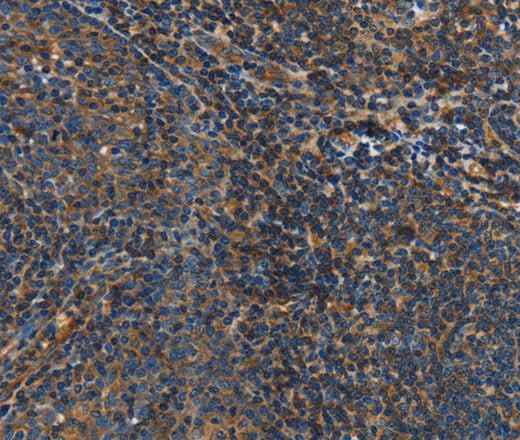 Anti-Human IL17D Antibody