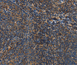 Anti-Human IL17D Antibody - ABMIUM