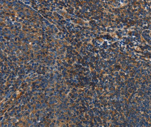 Anti-Human IL17D Antibody - ABMIUM