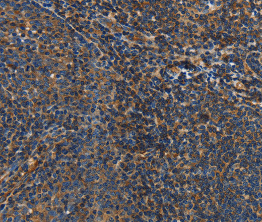 Anti-Human IL17D Antibody - ABMIUM