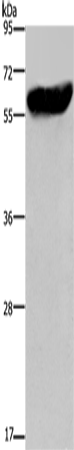 Anti-Human/Mouse/Rat CYP2E1 Antibody - ABMIUM