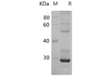 SDS-PAGE analysis of Rat DNMT1 proteins, 2 μg/lane of Recombinant Rat DNMT1 proteins was resolved with SDS-PAGE under reducing conditions, showing bands at 24.31 kDa.