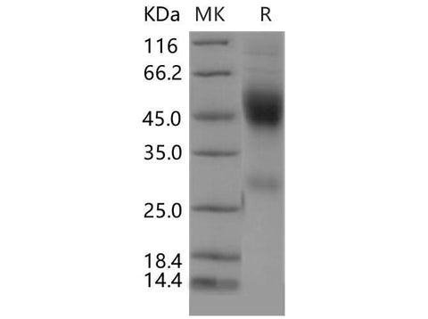 Recombinant Mouse Neurexophilin-1/NXPH1 Protein (His Tag) - ABMIUM