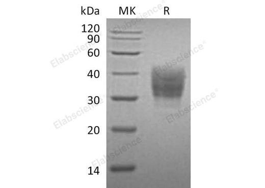 Recombinant Mouse SLAMF7/CD319 Protein (His Tag) - ABMIUM