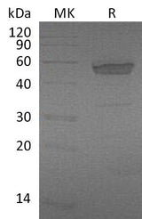 Recombinant Mouse EDA2R/TNFRSF27 Protein (Fc Tag) - ABMIUM