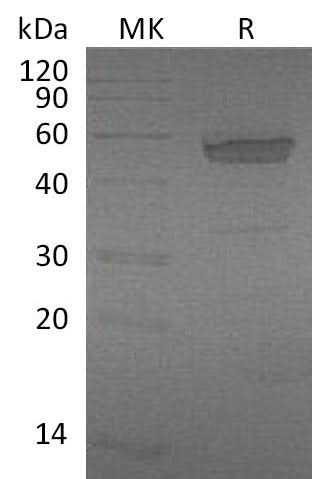 Recombinant Mouse EDA2R/TNFRSF27 Protein (Fc Tag) - ABMIUM
