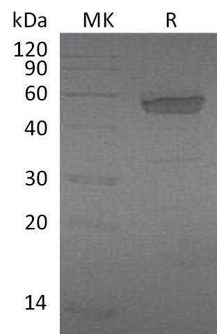 Recombinant Mouse EDA2R/TNFRSF27 Protein (Fc Tag) - ABMIUM
