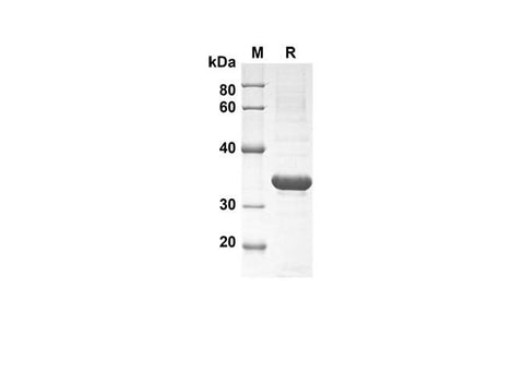 SDS-PAGE analysis of Rat IL-21 proteins , 2 μg/lane of Recombinant Rat IL-21 proteins was resolved with SDS-PAGE under reducing conditions , showing bands at 35 kDa.