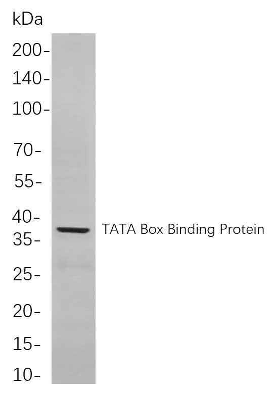 Anti-Human/Mouse/Rat TATA Box Binding Protein Antibody [B806] - ABMIUM