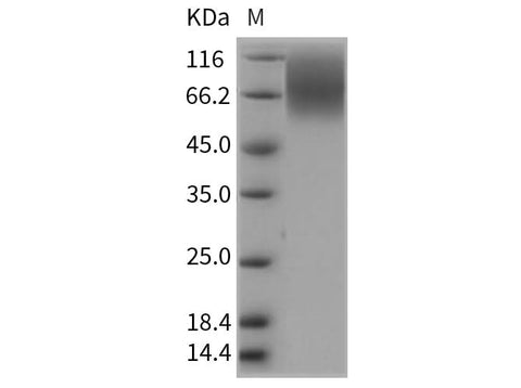 Recombinant Rat CEACAM1/CD66a Protein (His Tag) - ABMIUM