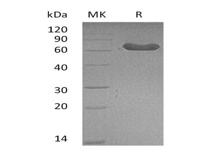 Recombinant Mouse LTBR/TNFRSF3 Protein (Fc Tag) - ABMIUM