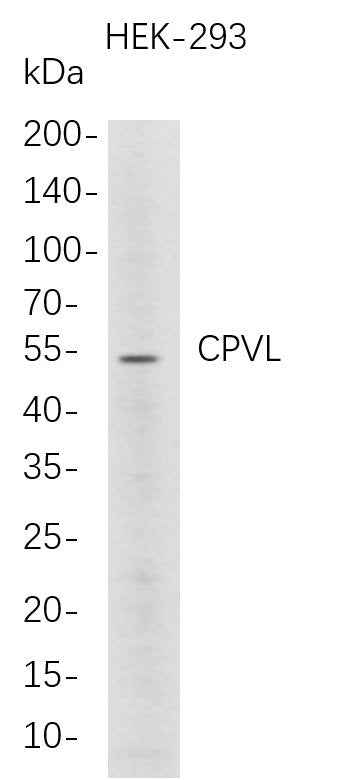 Anti-Human CPVL Antibody [B728] - ABMIUM
