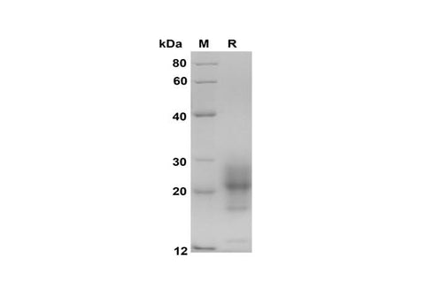 SDS-PAGE analysis of Mouse IL-5 proteins, 2 μg/lane of Recombinant Mouse IL-5 proteins was resolved with SDS-PAGE under reducing conditions, showing bands at 18-28 kDa.