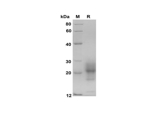 SDS-PAGE analysis of Mouse IL-5 proteins, 2 μg/lane of Recombinant Mouse IL-5 proteins was resolved with SDS-PAGE under reducing conditions, showing bands at 18-28 kDa.