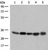 Western blot analysis of 231 PC-3 Hela A375 HepG2 cell lysates using COPE Polyclonal Antibody at dilution of 1:350