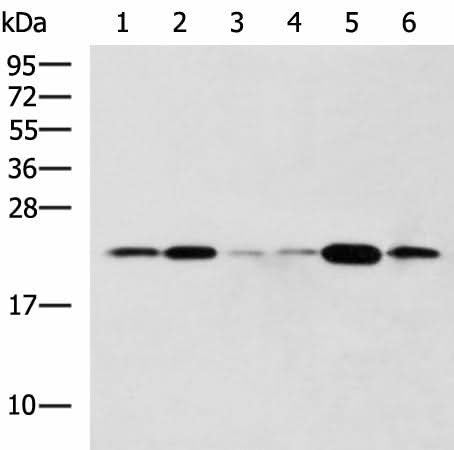 Western blot analysis of Raji Hela cell Mouse liver tissue Rat lung tissue Mouse Pancreas tissue NIH/3T3 cell lysates using TMED10 Polyclonal Antibody at dilution of 1:800