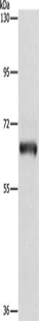 Anti-Human/Mouse/Rat KLC1 Antibody - ABMIUM