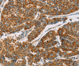 Anti-Human/Mouse DLL4 Antibody - ABMIUM