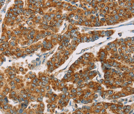 Anti-Human/Mouse DLL4 Antibody - ABMIUM