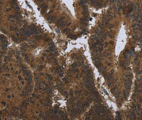 Anti-Human PIP Antibody