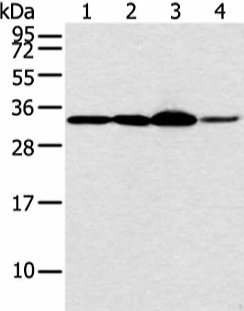 Western blot analysis of Hela and PC3 cell 231 cell and human esophagus cancer tissue using MED6 Polyclonal Antibody at dilution of 1:400