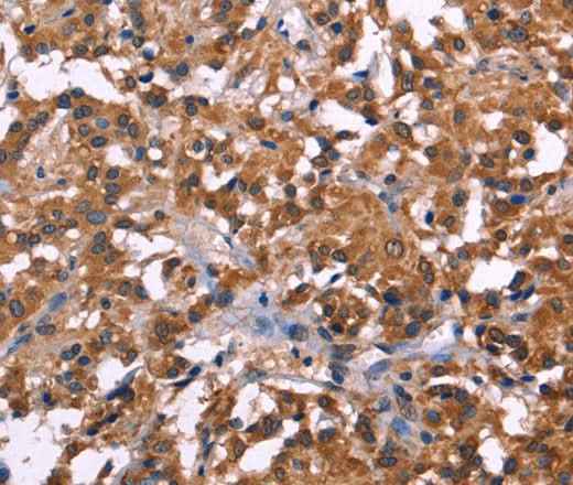 Anti-Human NOS2 Antibody