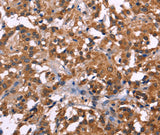 Anti-Human NOS2 Antibody - ABMIUM