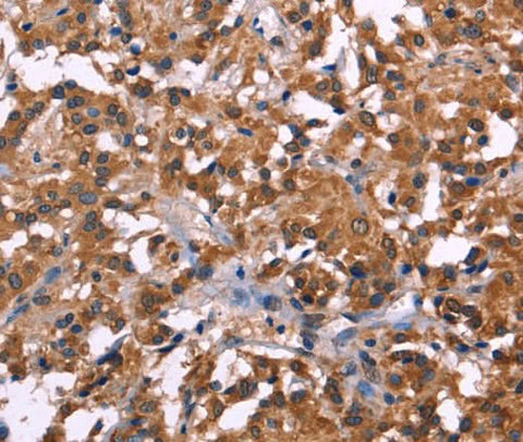 Anti-Human NOS2 Antibody - ABMIUM