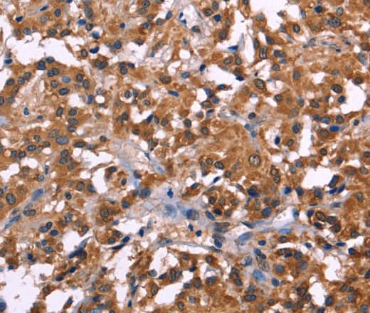 Anti-Human NOS2 Antibody - ABMIUM