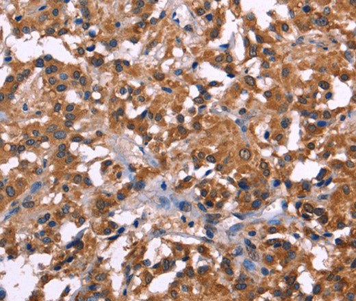 Anti-Human NOS2 Antibody - ABMIUM