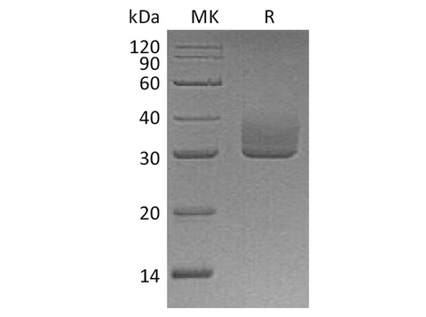 Recombinant Human ANGPTL3 Protein (His Tag) - ABMIUM