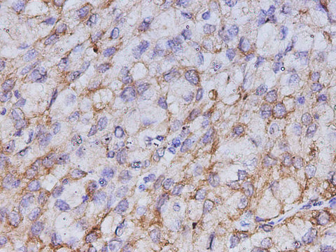 Anti-Human CK-7 Antibody - ABMIUM