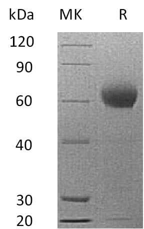 Recombinant Mouse Complement Factor H/CFH Protein (His Tag) - ABMIUM