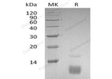 Recombinant Human CCL5/RANTES Protein - ABMIUM
