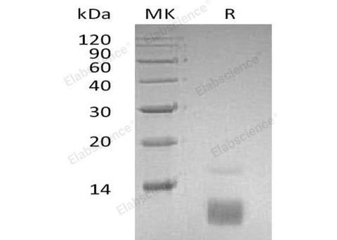 Recombinant Human CCL5/RANTES Protein - ABMIUM
