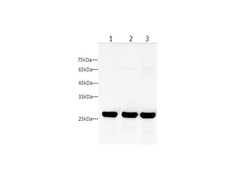 Anti-Human/Rat UCHL1 Antibody - ABMIUM