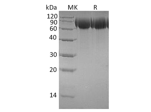 Recombinant Human TrkB/NTRK2 Protein (His Tag) - ABMIUM
