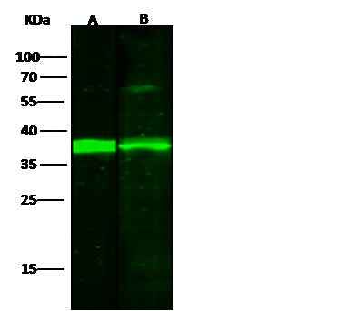 Anti-Human NFKBIA Antibody [B337] - ABMIUM