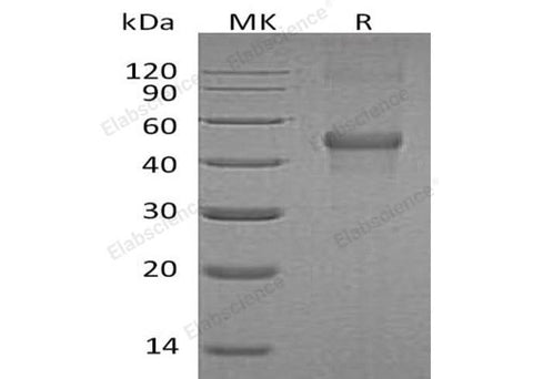 Recombinant Human LMCD1/Dyxin Protein (His Tag) - ABMIUM