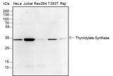 Anti-Human Thymidylate Synthase Antibody [A377]