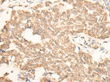 Anti-Human/Mouse EMSY Antibody - ABMIUM