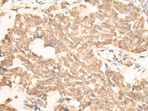 Anti-Human/Mouse EMSY Antibody - ABMIUM