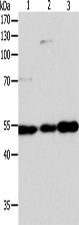 Anti-Human/Mouse/Rat GSR Antibody - ABMIUM