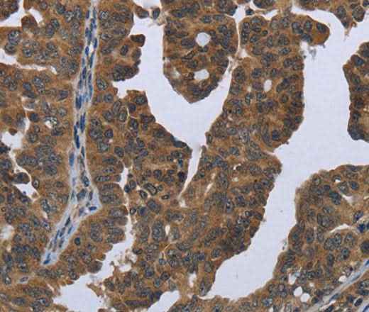 Anti-Human/Mouse/Rat GYS2 Antibody